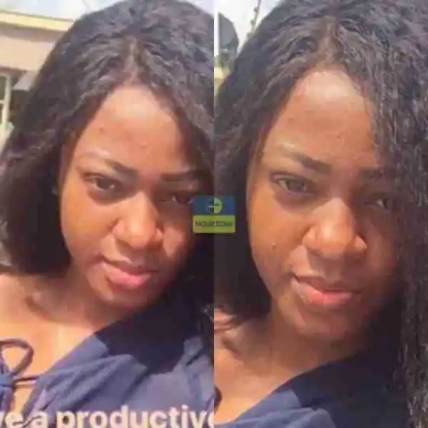 Former #BBNaija Housemate, Ahneeka Flaunts Her Pimples Face